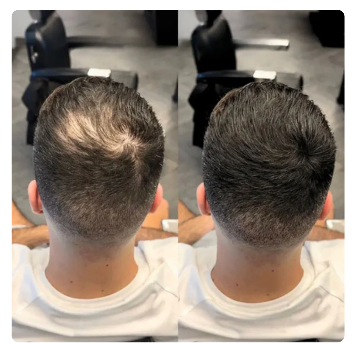 SafeHair® – Sofort volleres Haar in 5 Sekunden